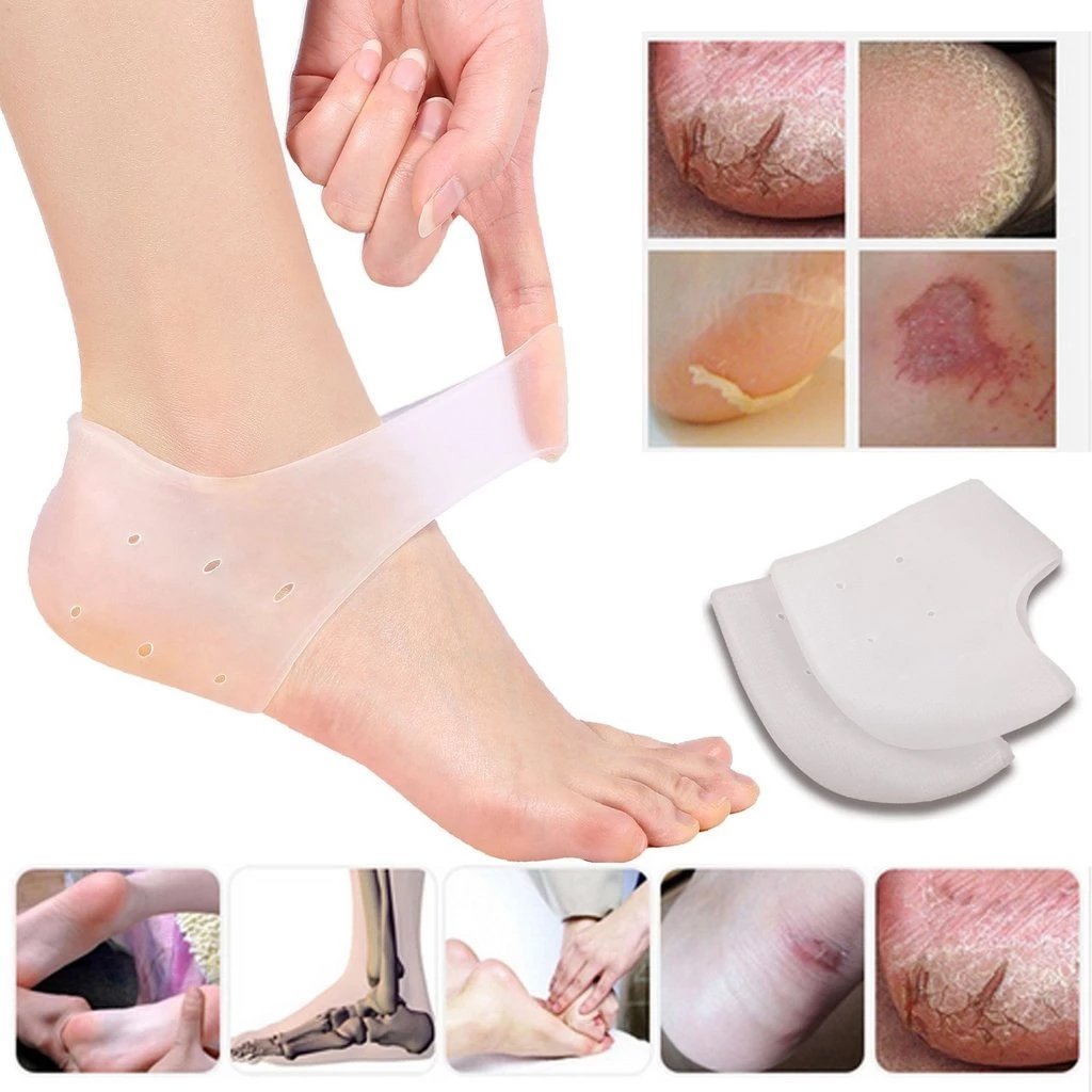 339 Moisturizing Skin Softening Silicone Gel for Dry Cracked Heel Repair (Multicolour) Sai Krupa Emart